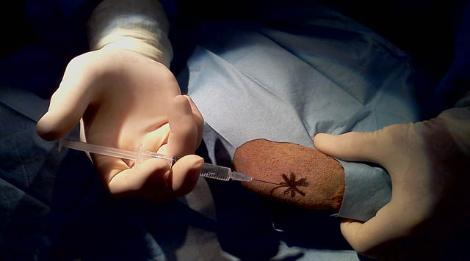 pet stem cell therapy 寵笏幹細胞治療 好處